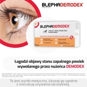blephademodex-chusteczki-do-higieny-powiek-jalowe-30-sztuk-17224110638.jpg