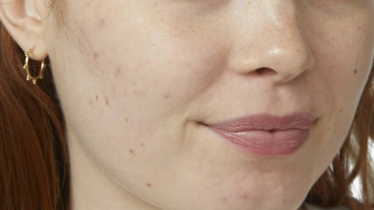 pobrane - 2025-08-22T113352.960.png