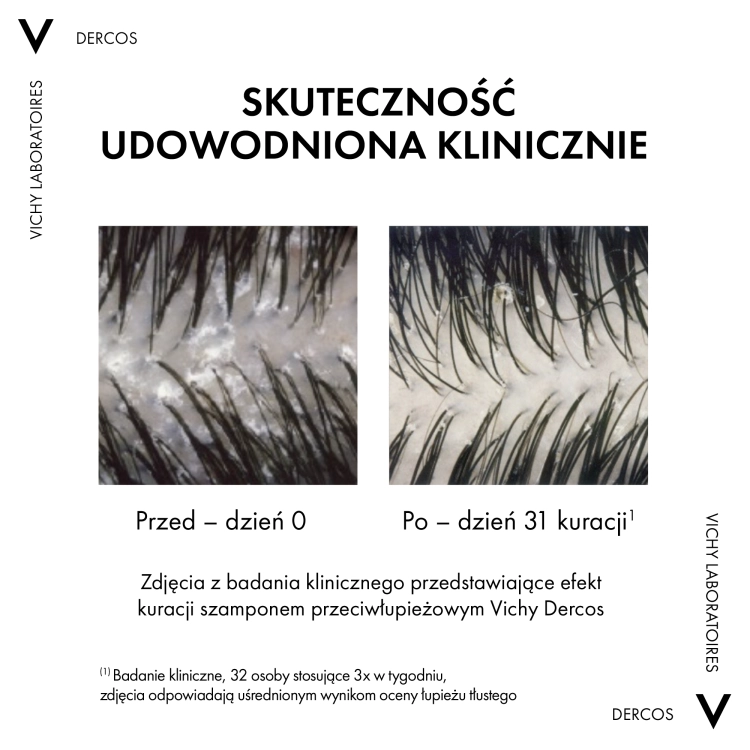 vichy-dercos-anti-dandruff-ds-szampon-przeciwlupiezowy-wlosy-normalne-i-przetluszczajace-sie-390-ml-17332318145.png