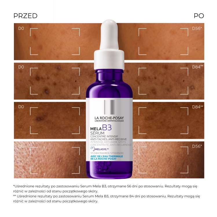 la-roche-posay-mela-b3-serum-przeciw-przebarwieniom-30-ml-17097261524.png