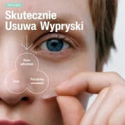 4-skutecznie-usuwa-wypryski.jpg