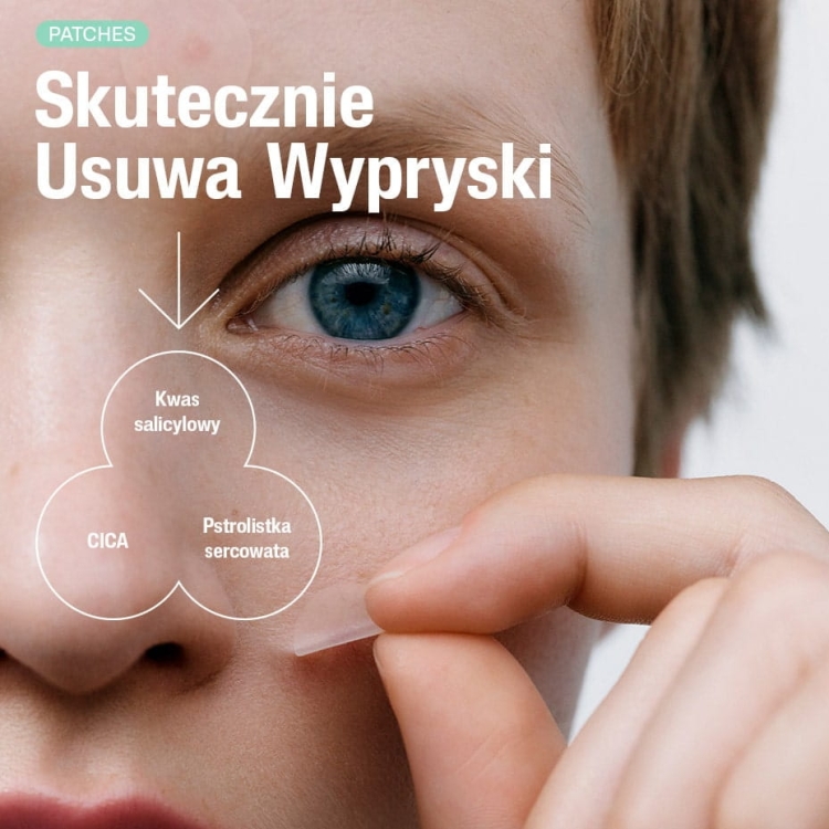 4-skutecznie-usuwa-wypryski.jpg