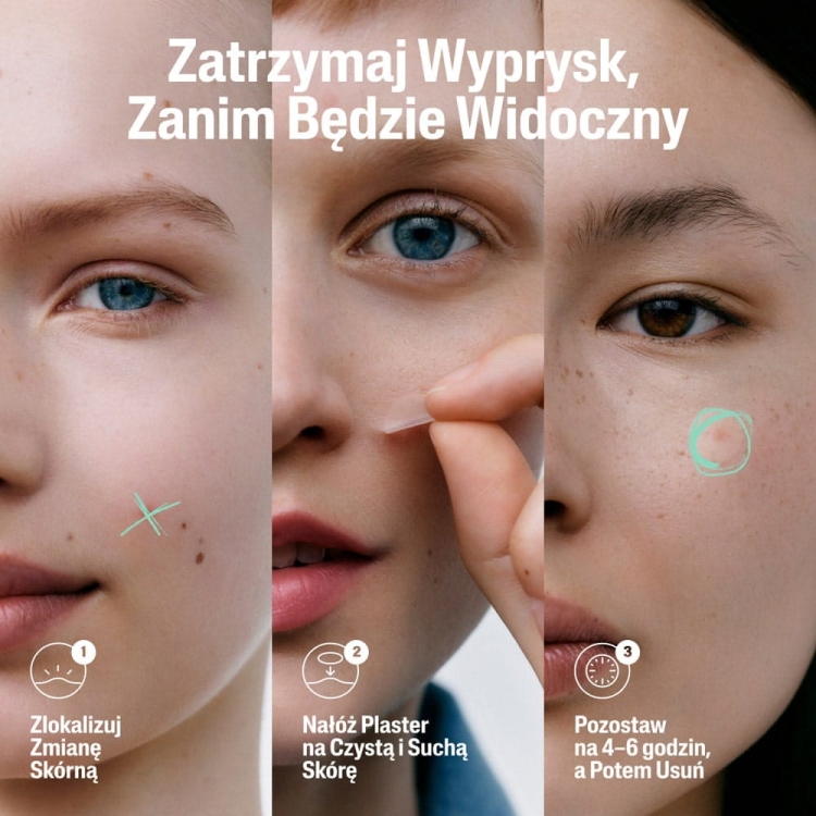 Zatrzymaj-Wyprysk-Zanim-Bedzie-Widoczny.jpg