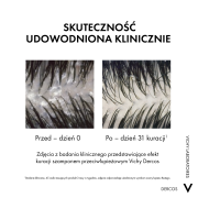 vichy-dercos-anti-dandruff-ds-szampon-przeciwlupiezowy-z-odzywka-2w1-200-ml-17334681835.png