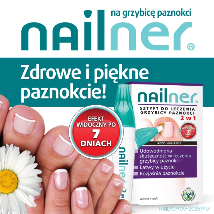 Nailner-sztyft-800x800_05.jpg