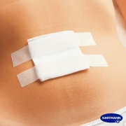 omnipor-25cm-x-5m-lepljiva-traka-61e5390c6a36d.webp