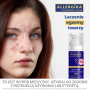 allergika-krem-do-twarzy-med-50-ml-17643309772.webp